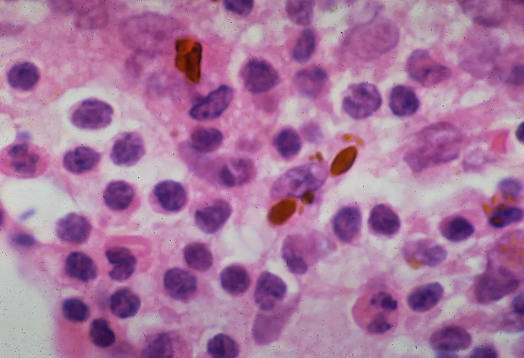Yeast (Saccharomyces cerevisiae) cells under a microscope