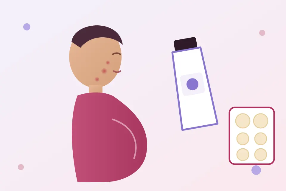 Acne during pregnancy: what to stop, what dermatologists suggest, and a simple routine