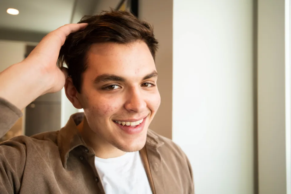 Types of acne explained: blackheads, whiteheads, papules, pustules, nodules and cysts