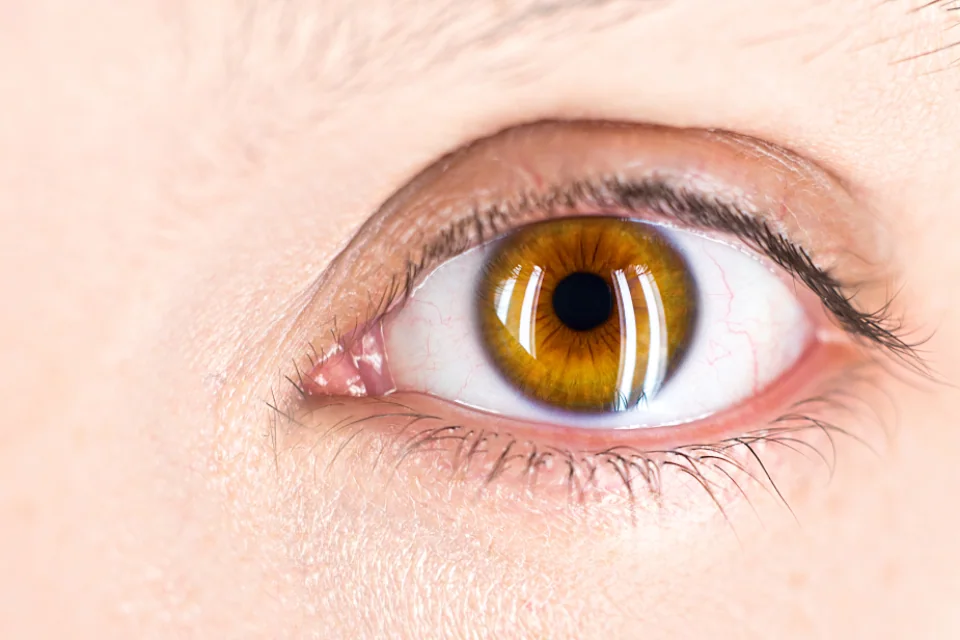 Best Eye Cream for Men: Puffiness and Lines